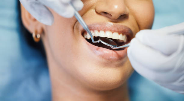 Best Emergency Dental Care for Broken or Chipped Teeth in Bellair Meadowbrook Terrace, FL